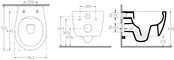 Подвесной унитаз безободковый «Allen Brau» Fantasy 4.11004.20/4.11005.20 белый с сиденьем дюропласт с микролифтом белое, изображение №4